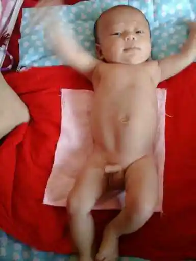 一周岁的宝宝小鸡鸡 还这样 着急 宝妈们帮忙看看 你们的宝宝有这样的