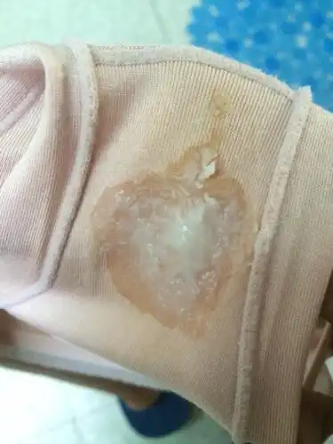 快来月经了,最近几天怎么突然有好多白带,白色的,没有异味,也不痒.