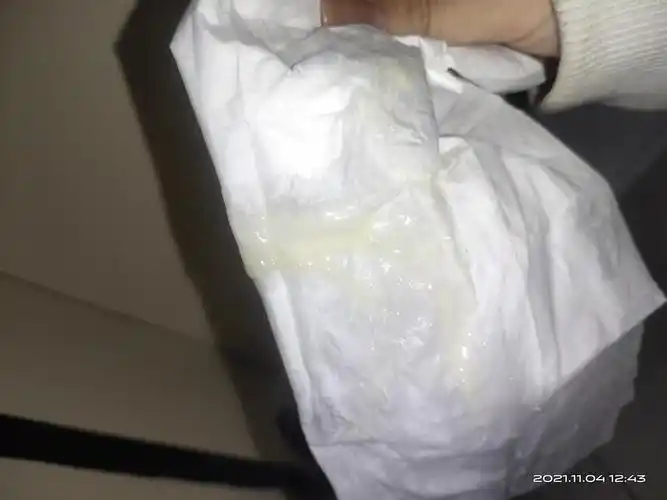 排卵期这样的白带正常吗