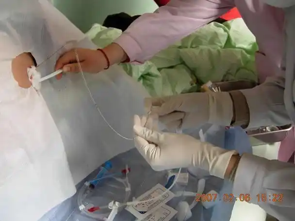 胸腔插管的过程