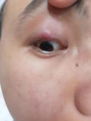 请问这是什么,要怎么治疗