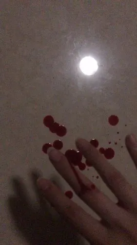 这个伤口需要打破伤风吗? 昨天晚上玻璃瓶划得.