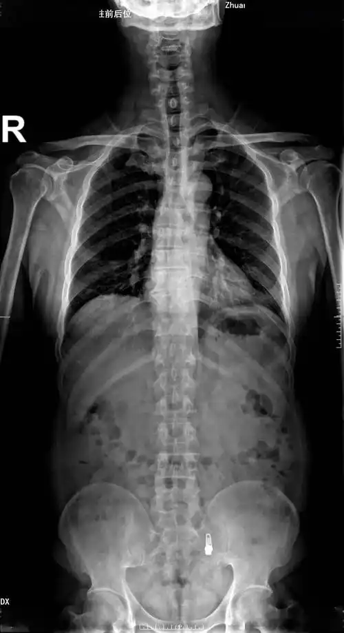 庄浪县人民医院先进科室--放射科_成像_检查_诊断