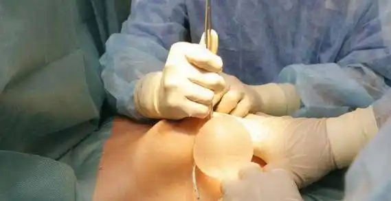 乳腺癌一期假体再造术后注意事项_乳房重建术_治疗介绍_护理及注意