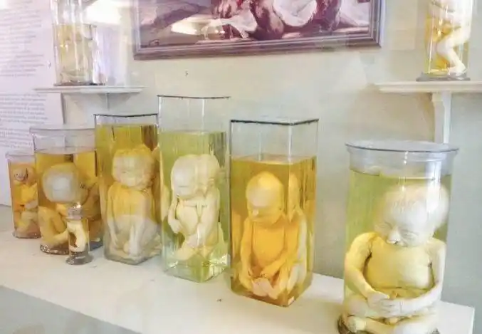 彼得大帝投入巨款收集各种巨人,畸形儿等人体标本,心理承受能力不达标