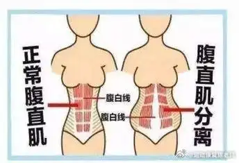 女性可能面临的生育损伤##女性生孩子的理由只有一个