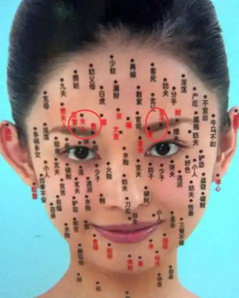 所以称为石崇巨富痣,石崇是西晋时期的大富巨富,好比现代社会里的首富