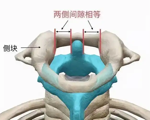 (正常状态)(旋转半脱位)寰枢关节是脊柱椎体中活动度最大的关节,是