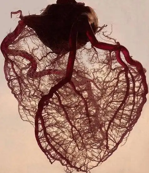 做心脏支架是利大还是弊大心血管医生给出最真实答案