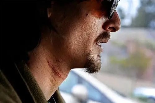 这周早些时候,他与女友吵了一架后,企图割喉自杀而在脖子上留下伤疤.