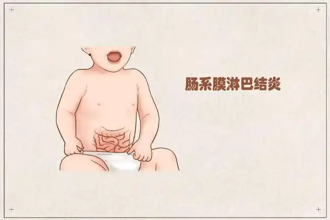 中医儿科杨晓孩子肚子痛反反复复家长需警惕肠系膜淋巴结炎