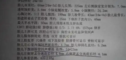 b超单上有这4个字,别以为是胎儿不健康,或许怀了一个"王子"_宝宝_单子