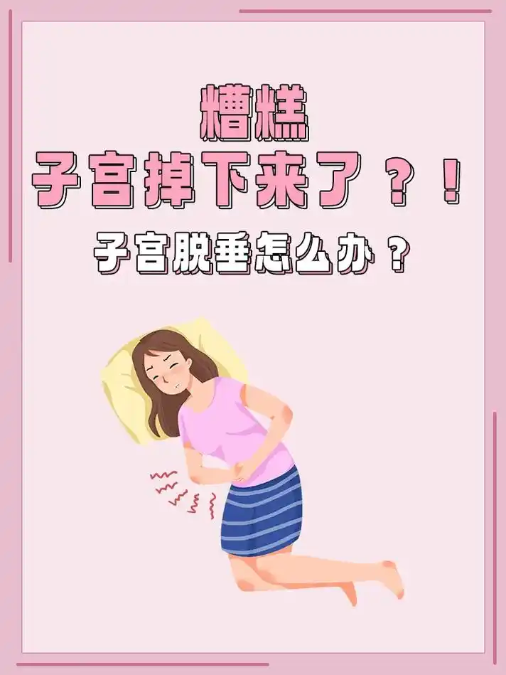 糟糕,子宫掉下来了99一文读懂子宫脱垂.