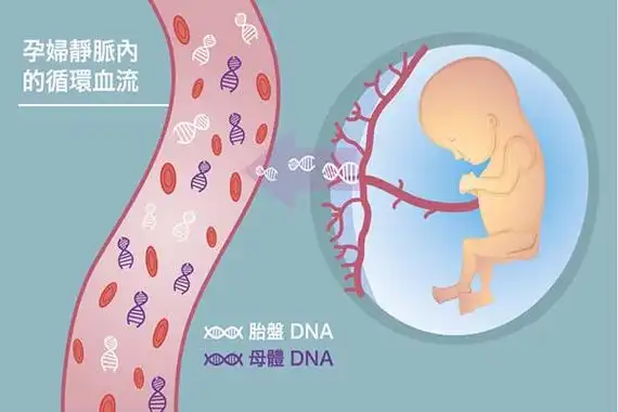 孕妈产检做无创dna检测到底有多重要?