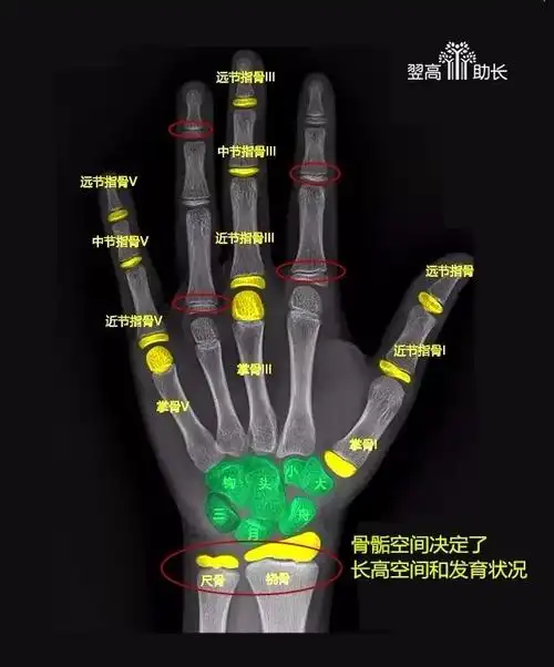 通常要拍摄人左手腕部的x光片,医生通过x光片观察左手掌指骨,腕骨及桡