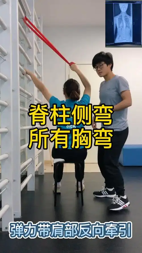 脊柱侧弯训练