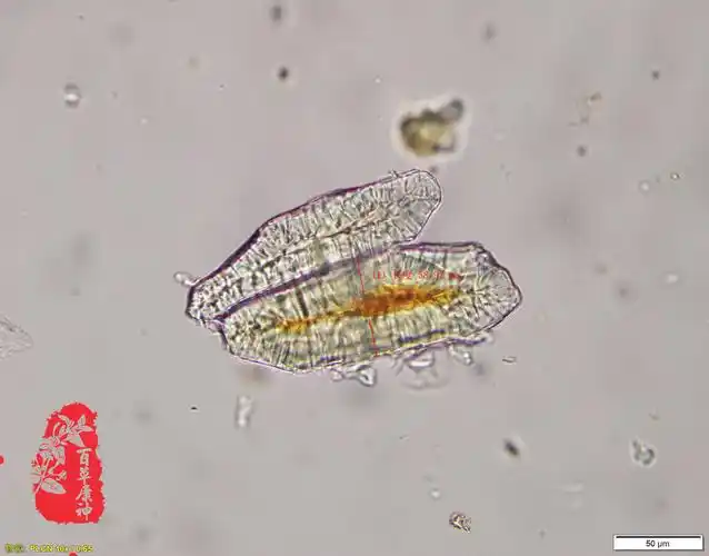 土茯苓深棕石细胞