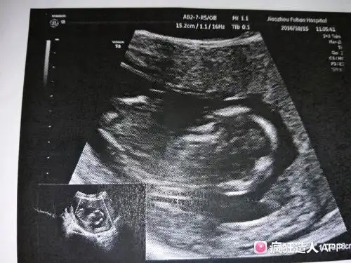 亲,帮忙给看一下男女,13