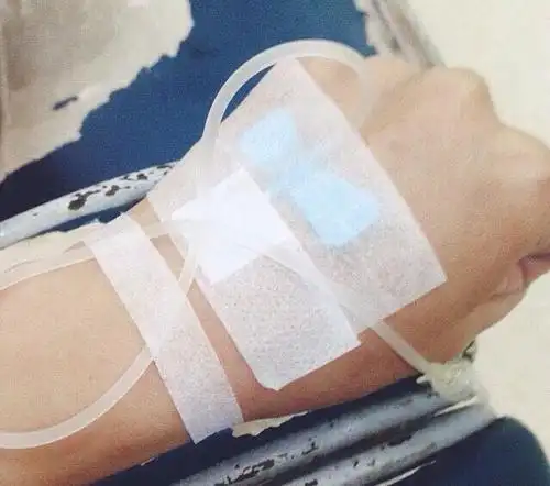 真人输液图片手部图片