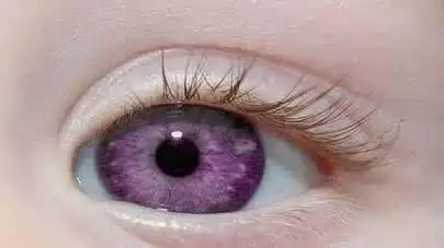 人的瞳孔图片 - 搜狗图片搜索