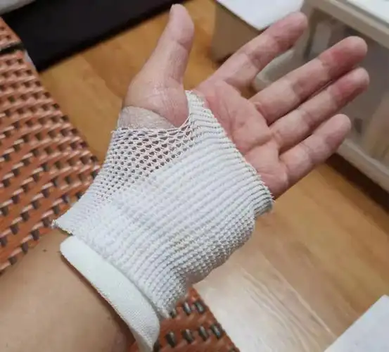 头部眩晕,不小心摔倒在地,左手掌及手臂摔伤,鲜血淋漓,自己简单包扎