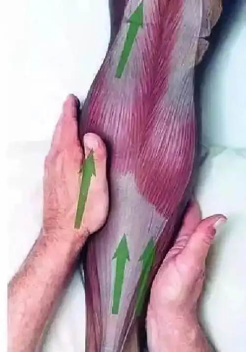 静脉曲张不痛不痒为何会变成致命杀手专家教你几招对抗蚯蚓腿