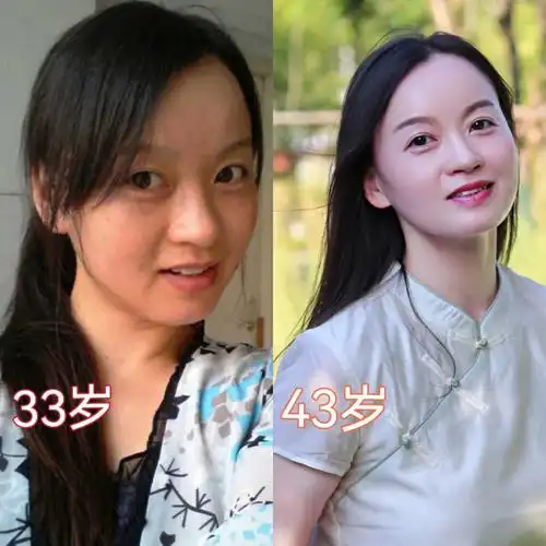 我和癌症晚期康复的姨都在变美为什么