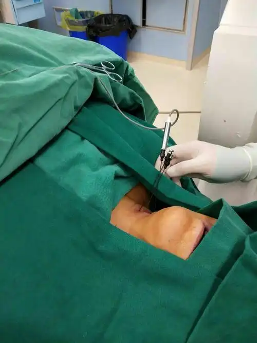 白银市第一人民医院疼痛科攻克" 多个颈椎间盘 "射频消融手术