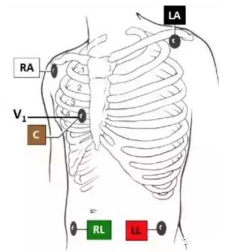 来看看这些需要注意的细节|导联|描记|受检者|avf_网易订阅