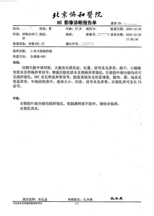 脑增强mri dwi核磁报告.jpg