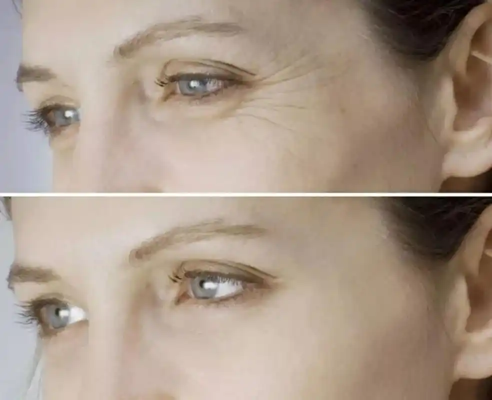 有眼纹老10岁这款法国眼部小熨斗细纹黑眼圈眼袋都看不见啦