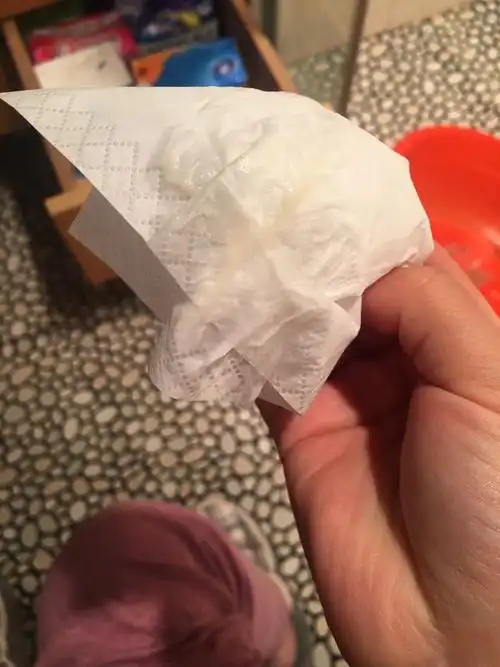 孕26周了有鼻涕状乳白色白带