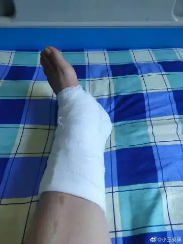 脚崴了,因为害怕伤到骨头就到医院做个检查,首先挂号,拍片.