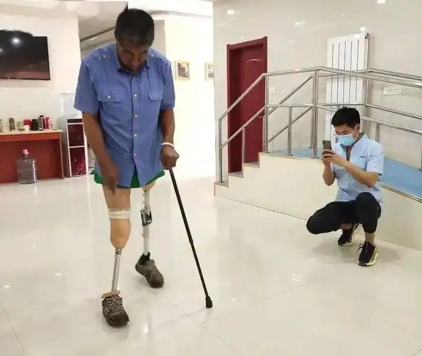 包头市244名肢体残疾人免费享受假肢,矫形器适配服务