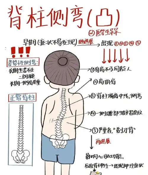 脊柱侧弯的危害