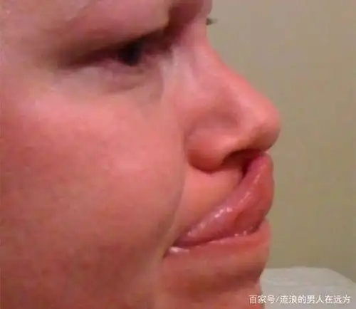 你能用舌头卷成三叶草吗?