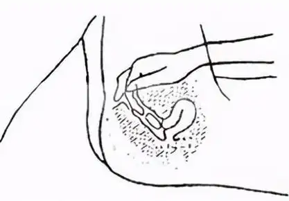 阴道栓如何正确使用