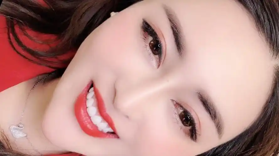 红唇白齿,唇唇欲动,红花当然配绿叶,私人订制:进口全瓷(玻璃瓷)贴片