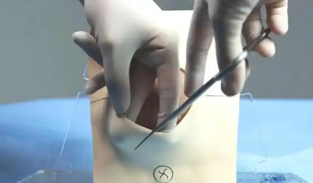 顺产开十指是什么概念看完这张图就能一目了然