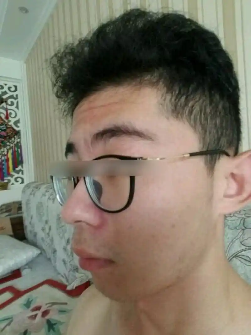 面相分析:  你的额头窄,少年运势不好,抬头纹太多不利于你发展.