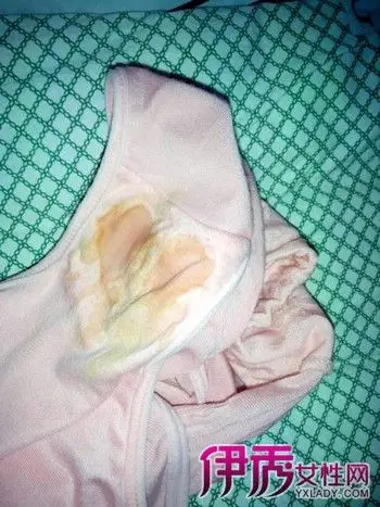 【图】黄绿色白带怎么办? 5大解决方法告诉你