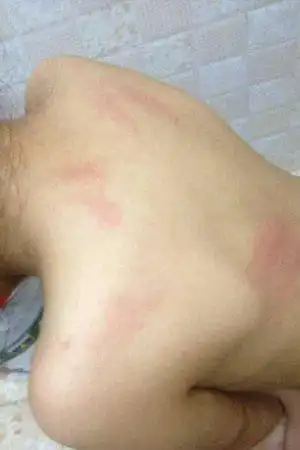 家长发帖反映小学教师体罚学生 涉事教师被处分