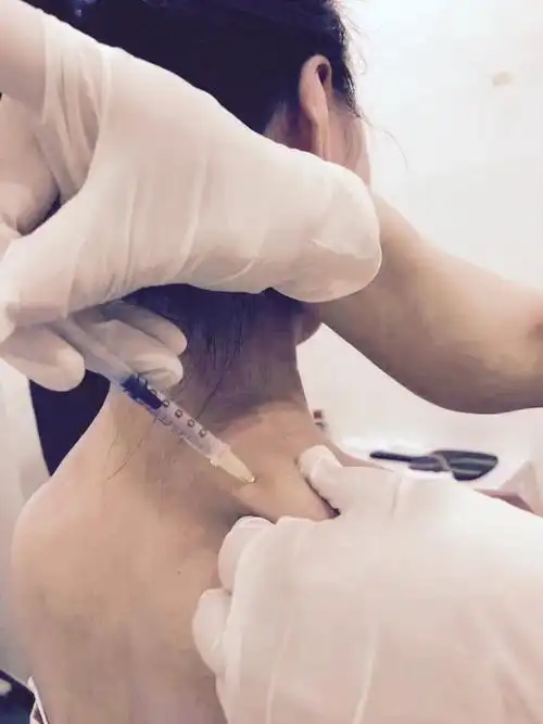 瘦肩针打肉毒素疼吗,瘦肩针注射斜方肌位置有副作用吗_小猪生活-女性