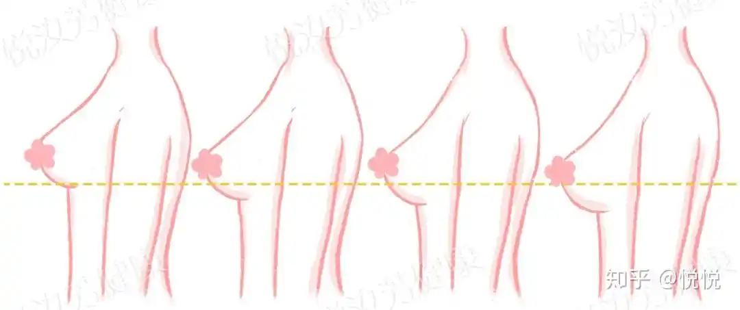 胸位有高低之分