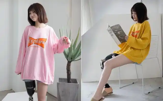 单腿女孩戴假肢,爱生活更爱舞蹈,圈粉无数被称为"励志女神"