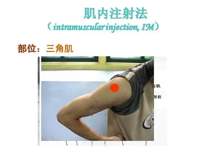 肌内注射法 (intramuscular injection, im) im) 部位: 部位:三角肌