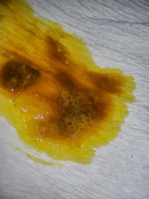 今天老是大便,但是第一次可以拉出来很多,接下来几个只拉一个点点粘液