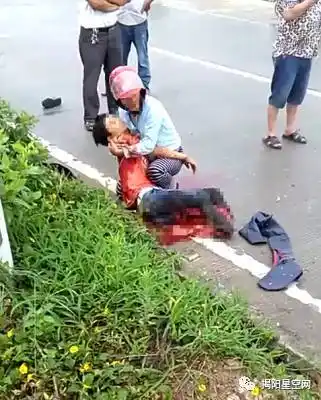 潮汕某地发生车祸,女子腿部骨肉分离!