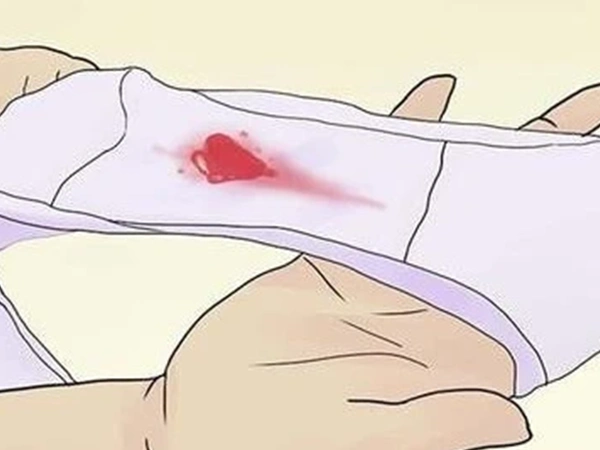 受精卵着床成功后出血是什么颜色的?跪求图片!-宝山助孕网