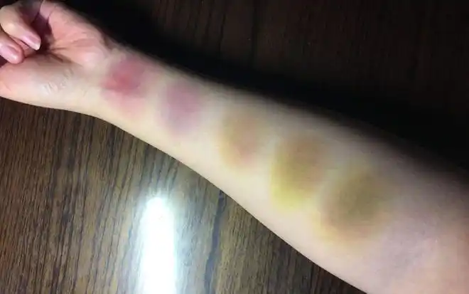 人死后一百天内如果不进行任何处理尸体会发生什么变化